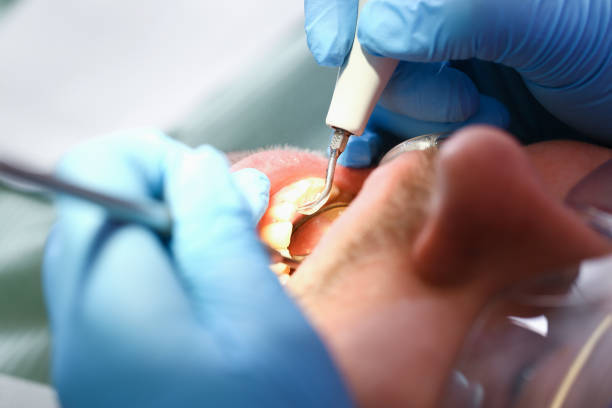 Best Emergency Gum Pain Relief  in Twentynine Palms, CA